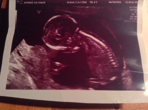 14-wk ultrasound